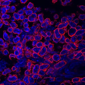 CD27/TNFRSF7 was detected in immersion fixed mouse splenocytes using Goat Anti-Human/Mouse CD27/TNFRSF7 Antigen Affinity-purified Polyclonal Antibody (Catalog # AF574) at 3 µg/mL for 3 hours at room temperature. Cells were stained using the NorthernLights™ 557-conjugated Anti-Goat IgG Secondary Antibody (red; Catalog # NL001) and counterstained with DAPI (blue). Specific staining was localized to plasma membrane. View our protocol for Fluorescent ICC Staining of Non-adherent Cells.