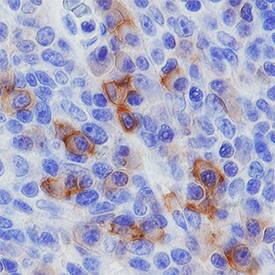 CD27/TNFRSF7 was detected in immersion fixed paraffin-embedded sections of human tonsil using Goat Anti-Human CD27/TNFRSF7 Biotinylated Antigen Affinity-purified Polyclonal Antibody (Catalog # BAF382) at 3 µg/mL overnight at 4 °C. Tissue was stained using the Anti-Goat HRP-DAB Cell & Tissue Staining Kit (brown; Catalog # CTS008) and counterstained with hematoxylin (blue). Specific staining was localized to lymphocytes in germinal center. View our protocol for Chromogenic IHC Staining of Paraffin-embedded Tissue Sections.