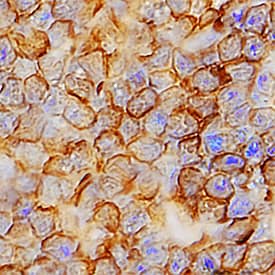 Immunohistochemistry TMIGD2 Antibody (953728) [Unconjugated]