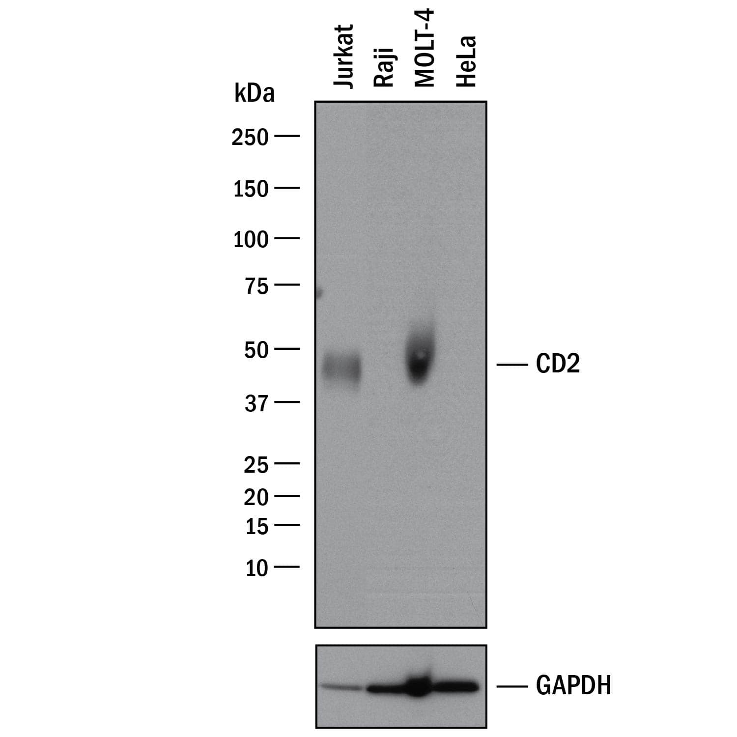 Western blot shows lysates of Jurkat human acute T cell leukemia cell line, Raji human Burkitt's lymphoma cell line (negative control), MOLT-4 human acute lymphoblastic leukemia cell line, and HeLa human cervical epithelial carcinoma cell line (negative control). PVDF membrane was probed with 0.5 µg/mL of Goat Anti-Human CD2 Antigen Affinity-purified Polyclonal Antibody (Catalog # AF1856) followed by HRP-conjugated Anti-Goat IgG Secondary Antibody (Catalog # HAF017). A specific band was detected for CD2 at approximately 48 kDa (as indicated). GAPDH (Catalog # AF5718) is shown as a loading control. This experiment was conducted under reducing conditions and using Immunoblot Buffer Group 1.
