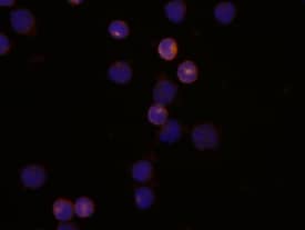 CD2 was detected in immersion fixed human peripheral blood mononuclear cells (PBMCs) using 10 µg/mL Mouse Anti-Human CD2 Monoclonal Antibody (Catalog # MAB18561) for 3 hours at room temperature. Cells were stained with the NorthernLights™ 557-conjugated Donkey Anti-Mouse IgG Secondary Antibody (red; Catalog # NL007) and counterstained with DAPI (blue). View our protocol for Fluorescent ICC Staining of Non-adherent Cells.