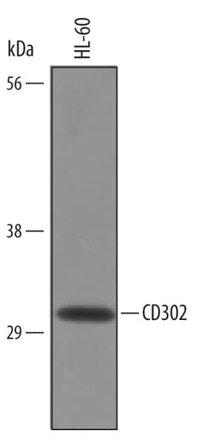 Western Blot CD302/CLEC13A Antibody