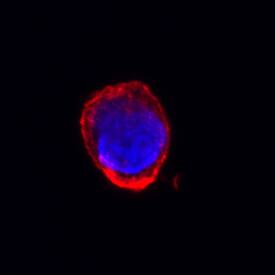 CD30/TNFRSF8 was detected in immersion fixed Jurkat human acute T cell leukemia cell line using Goat Anti-Human CD30/TNFRSF8 Antigen Affinity-purified Polyclonal Antibody (Catalog # AF229) at 10 &micro;g/mL for 3 hours at room temperature. Cells were stained using the NorthernLights&trade; 557-conjugated Anti-Goat IgG Secondary Antibody (red; NL001) and counterstained with DAPI (blue). Specific staining was localized to cell membrane and cytoplasm. View our protocol for Fluorescent ICC Staining of Non-adherent Cells.