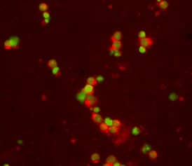 CD30/TNFRSF8 was detected in immersion fixed mouse splenocytes using 15 µg/mL Goat Anti-Mouse CD30/TNFRSF8 Antigen Affinity-purified Polyclonal Antibody (Catalog # AF852) for 3 hours at room temperature. Cells were stained (red) and counterstained (green). View our protocol for Fluorescent ICC Staining of Non-adherent Cells.