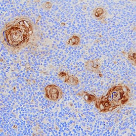 Immunohistochemistry CD30 Ligand/TNFSF8 Antibody [Unconjugated]