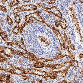 <b>Biological Strategies Validation. </b>CD30 Ligand/TNFSF8 was detected in immersion fixed paraffin-embedded sections of human spleen using Mouse Anti-Human CD30 Ligand/TNFSF8 Monoclonal Antibody (Catalog # MAB10281) at 5 µg/mL for 1 hour at room temperature followed by incubation with the Anti-Mouse IgG VisUCyte™ HRP Polymer Antibody (Catalog # VC001). Before incubation with the primary antibody, tissue was subjected to heat-induced epitope retrieval using Antigen Retrieval Reagent-Basic (Catalog # CTS013). Tissue was stained using DAB (brown) and counterstained with hematoxylin (blue). Specific staining was localized to cell surface. View our protocol for IHC Staining with VisUCyte HRP Polymer Detection Reagents.
