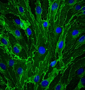 CD31/PECAM-1 was detected in immersion fixed bEnd.3 mouse endothelioma cell line using Goat Anti-Human/Mouse/Rat CD31/PECAM-1 Antigen Affinity-purified Polyclonal Antibody (Catalog # AF3628) at 10 µg/mL for 3 hours at room temperature. Cells were stained using the NorthernLights™ 493-conjugated Anti-Goat IgG Secondary Antibody (green; NL003) and counterstained with DAPI (blue). Specific staining was localized to cell membrane. View our protocol for Fluorescent ICC Staining of Cells on Coverslips.