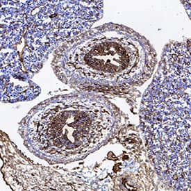 CD31/PECAM-1 was detected in immersion fixed frozen sections of mouse embryo (14 d.p.c.) using Goat Anti-Human/Mouse/Rat CD31/PECAM-1 Antigen Affinity-purified Polyclonal Antibody (Catalog # AF3628) at 10 µg/mL for 1 hour at room temperature followed by incubation with the Anti-Goat IgG VisUCyte™ HRP Polymer Antibody (VC004). Tissue was stained using DAB (brown) and counterstained with hematoxylin (blue). Specific staining was localized to developing guts. View our protocol for IHC Staining with VisUCyte HRP Polymer Detection Reagents.