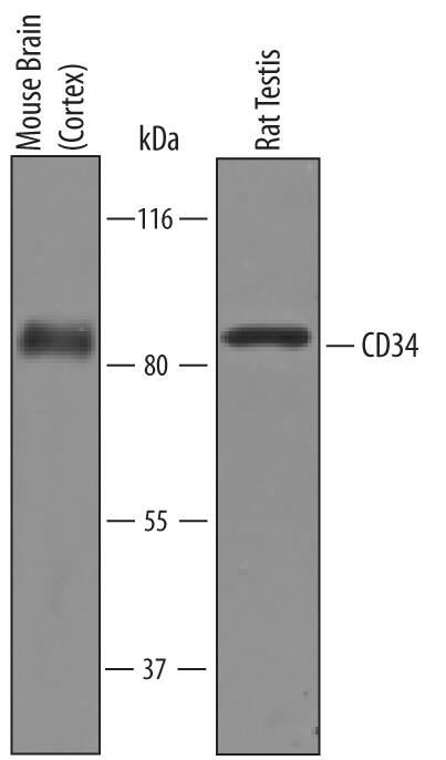 Western blot shows lysates of mouse brain (cortex) tissue and rat testis tissue. PVDF Membrane was probed with 1 µg/mL of Mouse CD34 Antigen Affinity-purified Polyclonal Antibody (Catalog # AF6518) followed by HRP-conjugated Anti-Sheep IgG Secondary Antibody (Catalog # HAF016). A specific band was detected for CD34 at approximately 85-90 kDa (as indicated). This experiment was conducted under reducing conditions and using Immunoblot Buffer Group 8.