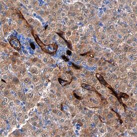 CD34 was detected in immersion fixed paraffin-embedded sections of human liver using Sheep Anti-Human CD34 Antigen Affinity-purified Polyclonal Antibody (Catalog # AF7227) at 1.7 µg/mL overnight at 4 °C. Tissue was stained using the Anti-Sheep HRP-DAB Cell & Tissue Staining Kit (brown; Catalog # CTS019) and counterstained with hematoxylin (blue). Specific staining was localized to endothelial cells in vasculature. View our protocol for Chromogenic IHC Staining of Paraffin-embedded Tissue Sections.