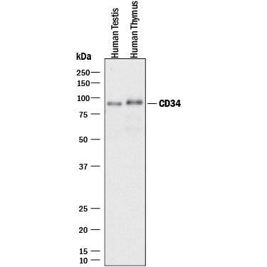 Western blot shows lysates of human testies tissue and human thymus tissue. PVDF membrane was probed with 0.5 µg/mL of Sheep Anti-Human CD34 Antigen Affinity-purified Polyclonal Antibody (Catalog # AF7227) followed by HRP-conjugated Anti-Sheep IgG Secondary Antibody (Catalog # HAF016). A specific band was detected for CD34 at approximately 110 kDa (as indicated). This experiment was conducted under reducing conditions and using Immunoblot Buffer Group 1.