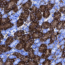 CD36/SR-B3 was detected in immersion fixed paraffin-embedded sections of mouse kidney using Goat Anti-Mouse CD36/SR-B3 Antigen Affinity-purified Polyclonal Antibody (Catalog # AF2519) at 3 µg/mL for 1 hour at room temperature followed by incubation with the Anti-Goat IgG VisUCyte™ HRP Polymer Antibody (Catalog # VC004). Before incubation with the primary antibody, tissue was subjected to heat-induced epitope retrieval using Antigen Retrieval Reagent-Basic (Catalog # CTS013). Tissue was stained using DAB (brown) and counterstained with hematoxylin (blue). Specific staining was localized to cytoplasm and plasma membrane. View our protocol for IHC Staining with VisUCyte HRP Polymer Detection Reagents.