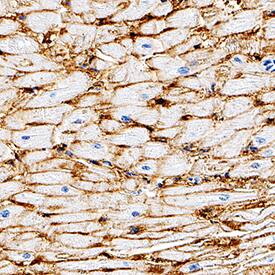 CD36/SR-B3 was detected in immersion fixed paraffin-embedded sections of human heart using Mouse Anti-Human CD36/SR-B3 Monoclonal Antibody (Catalog # MAB19552) at 5 µg/mL for 1 hour at room temperature followed by incubation with Anti-Mouse IgG VisUCyte™ HRP Polymer Antibody (Catalog # VC001). Tissue was stained with DAB (brown) and counterstained with hematoxylin (blue). Specific staining was localized to plasma membrane. View our protocol for Chromogenic IHC Staining of Paraffin-embedded Tissue Sections.