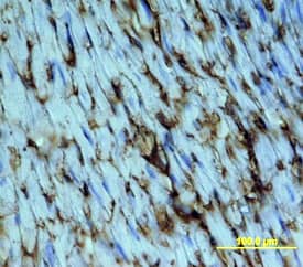 CD36/SR-B3 was detected in immersion fixed frozen sections of mouse heart using Rat Anti-Mouse CD36/SR-B3 Monoclonal Antibody (Catalog # MAB25191) at 15 µg/mL overnight at 4 °C. Tissue was stained using the Anti-Rat HRP-DAB Cell & Tissue Staining Kit (brown; Catalog # CTS017) and counterstained with hematoxylin (blue). Specific staining was localized to cell surfaces and cytoplasm. View our protocol for Chromogenic IHC Staining of Frozen Tissue Sections.