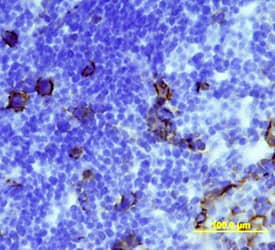CD36/SR-B3 was detected in immersion fixed frozen sections of mouse thymus using Rat Anti-Mouse CD36/SR-B3 Monoclonal Antibody (Catalog # MAB25191) at 15 µg/mL overnight at 4 °C. Tissue was stained using the Anti-Rat HRP-DAB Cell & Tissue Staining Kit (brown; Catalog # CTS017) and counterstained with hematoxylin (blue). Specific staining was localized to cell surfaces and cytoplasm. View our protocol for Chromogenic IHC Staining of Frozen Tissue Sections.