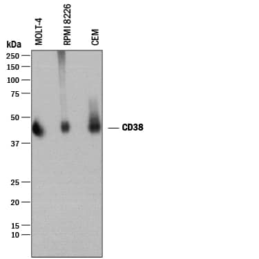 Western blot shows lysates of MOLT-4 human acute lymphoblastic leukemia cell line, RPMI 8226 human multiple myeloma cell line, and CEM human T-lymphoblastoid cell line. PVDF membrane was probed with 0.1 µg/mL of Sheep Anti-Human CD38 Antigen Affinity-purified Polyclonal Antibody (Catalog # AF2404) followed by HRP-conjugated Anti-Sheep IgG Secondary Antibody (Catalog # HAF016). A specific and diffuse band was detected for CD38 at approximately 45 kDa (as indicated). This experiment was conducted under reducing conditions and using Immunoblot Buffer Group 1.