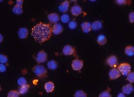 CD38 was detected in immersion fixed human peripheral blood mononuclear cells (PBMCs) using 10 µg/mL Mouse Anti-Human CD38 Monoclonal Antibody (Catalog # MAB2404) for 3 hours at room temperature. Cells were stained with the NorthernLights™ 557-conjugated Anti-Mouse IgG Secondary Antibody (red; NL007) and counterstained with DAPI (blue). View our protocol for Fluorescent ICC Staining of Non-adherent Cells.