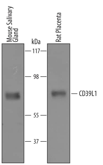 Western blot shows lysates of mouse salivary gland tissue and rat placenta tissue. PVDF Membrane was probed with 1 µg/mL of Sheep Anti-Mouse/Rat CD39L1/ENTPD2 Antigen Affinity-purified Polyclonal Antibody (Catalog # AF5797) followed by HRP-conjugated Anti-Sheep IgG Secondary Antibody (Catalog # HAF016). A specific band was detected for CD39L1/ENTPD2 at approximately 80 kDa (as indicated). This experiment was conducted under reducing conditions and using Immunoblot Buffer Group 8.
