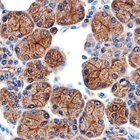 CD39L3/ENTPD3 was detected in immersion fixed paraffin-embedded sections of human salivary gland using Sheep Anti-Human CD39L3/ENTPD3 Antigen Affinity-purified Polyclonal Antibody (Catalog # AF4400) at 3 µg/mL overnight at 4 °C. Before incubation with the primary antibody, tissue was subjected to heat-induced epitope retrieval using Antigen Retrieval Reagent-Basic (Catalog # CTS013). Tissue was stained using the Anti-Sheep HRP-DAB Cell & Tissue Staining Kit (brown; Catalog # CTS019) and counterstained with hematoxylin (blue). Specific staining was localized to the plasma membranes of epithelial cells. View our protocol for Chromogenic IHC Staining of Paraffin-embedded Tissue Sections.