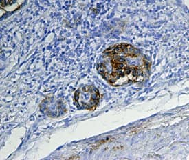 CD39L3/ENTPD3 was detected in immersion fixed paraffin-embedded sections of human pancreas using Sheep Anti-Human CD39L3/ENTPD3 Antigen Affinity-purified Polyclonal Antibody (Catalog # AF4400) at 15 µg/mL overnight at 4 °C. Tissue was stained using the Anti-Sheep HRP-DAB Cell & Tissue Staining Kit (brown; Catalog # CTS019) and counterstained with hematoxylin (blue). Specific staining was localized to pancreatic islets. View our protocol for Chromogenic IHC Staining of Paraffin-embedded Tissue Sections.