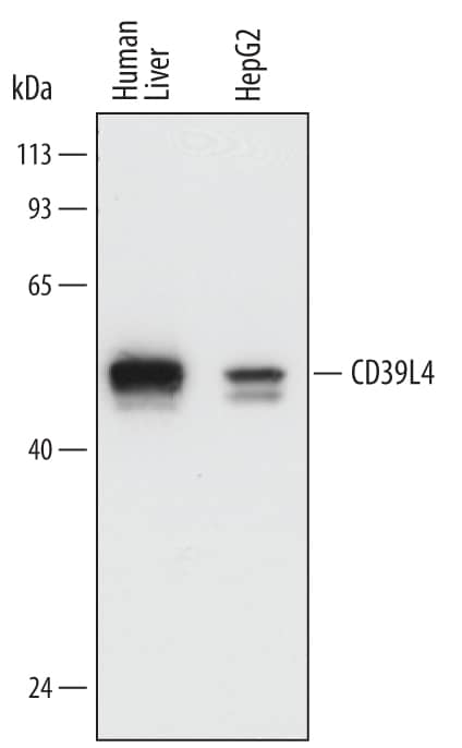 Western blot shows lysates of human liver tissue and HepG2 human hepatocellular carcinoma cell line. PVDF membrane was probed with 0.2 µg/mL of Mouse Anti-Human CD39L4/ENTPD5 Monoclonal Antibody (Catalog # MAB5297) followed by HRP-conjugated Anti-Mouse IgG Secondary Antibody (Catalog # HAF007). A specific band was detected for CD39L4/ENTPD5 at approximately 48 kDa (as indicated). This experiment was conducted under reducing conditions and using Immunoblot Buffer Group 1.