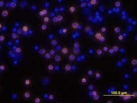 CD3 was detected in immersion fixed mouse splenocytes using Rat Anti-Mouse CD3 Biotinylated Monoclonal Antibody (Catalog # BAM4841) at 10 µg/mL for 3 hours at room temperature. Cells were stained using the NorthernLights™ 557-conjugated Streptavidin (yellow; Catalog # NL999) and counterstained with DAPI (blue). View our protocol for Fluorescent ICC Staining of Non-adherent Cells.