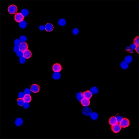 CD3 was detected in immersion fixed mouse splenocytes using Rat Anti-Mouse CD3 Monoclonal Antibody (Catalog # MAB4841R) at 3 µg/mL for 3 hours at room temperature. Cells were stained using the NorthernLights™ 557-conjugated Anti-Mouse IgG Secondary Antibody (red; Catalog # NL007) and counterstained with DAPI (blue). Specific staining was localized to cell membrane. View our protocol for Fluorescent ICC Staining of Non-adherent Cells.