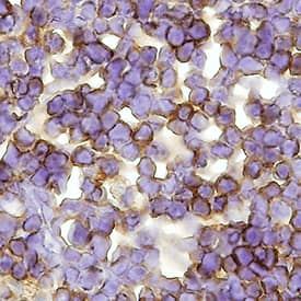 CD3 was detected in immersion fixed paraffin-embedded sections of mouse spleen tissue using Rat Anti-Mouse CD3 Monoclonal Antibody (Catalog # MAB4841R) at 15 µg/mL for 1 hour at room temperature followed by incubation with the Anti-Rat IgG VisUCyte™ HRP Polymer Antibody (Catalog # VC005). Before incubation with the primary antibody, tissue was subjected to heat-induced epitope retrieval using Antigen Retrieval Reagent-Basic (Catalog # CTS013). Tissue was stained using DAB (brown) and counterstained with hematoxylin (blue). Specific staining was localized to cell membrane in lymphocytes. View our protocol for IHC Staining with VisUCyte HRP Polymer Detection Reagents.