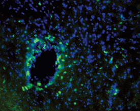 CD3 was detected in perfusion fixed HSV-1 infected frozen sections of mouse brain (perivascular cuffing) using 10 µg/mL Rat Anti-Mouse CD3 Monoclonal Antibody (Catalog # MAB4841) overnight at 4 °C. Tissue was stained using the NorthernLights™ 493-conjugated Anti-Rat IgG Secondary Antibody (green; NL015) and counterstained with DAPI (blue). View our protocol for Fluorescent IHC Staining of Frozen Tissue Sections.