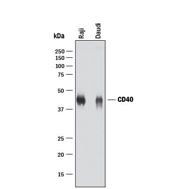 Western blot shows lysates of Raji human Burkitt's lymphoma cell line and Daudi human Burkitt's lymphoma cell line. PVDF membrane was probed with 2 µg/mL of Goat Anti-Human CD40/TNFRSF5 Antigen Affinity-purified Polyclonal Antibody (Catalog # AF632) followed by HRP-conjugated Anti-Goat IgG Secondary Antibody (HAF017). A specific band was detected for CD40/TNFRSF5 at approximately 40-45 kDa (as indicated). This experiment was conducted under reducing conditions and using Immunoblot Buffer Group 1.