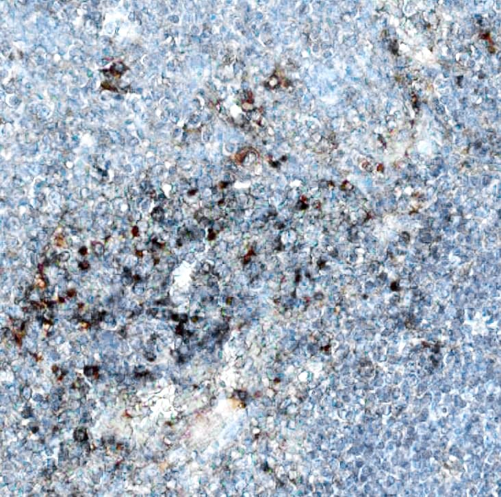 Immunohistochemistry CD40 Ligand/TNFSF5 Antibody (40804) [Unconjugated]