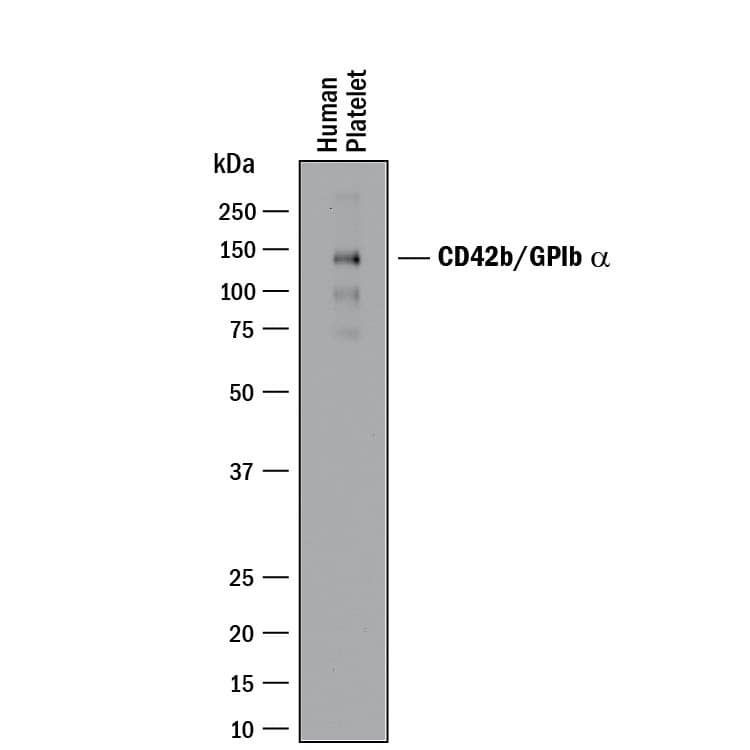 Western Blot CD42b/GPIb alpha Antibody [Unconjugated]