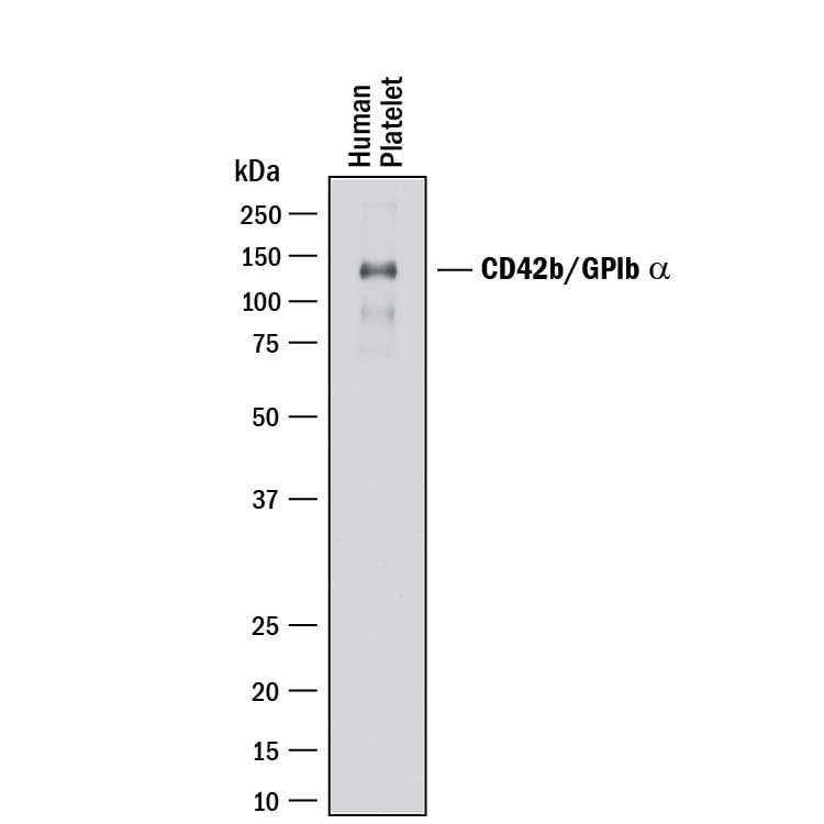 Western blot shows lysates of human platelets. PVDF membrane was probed with 2 µg/mL of Mouse Anti-Human CD42b/GPIb a Monoclonal Antibody (Catalog # MAB4067) followed by HRP-conjugated Anti-Mouse IgG Secondary Antibody (Catalog # HAF018). A specific band was detected for CD42b/GPIb a at approximately 135 kDa (as indicated). This experiment was conducted under reducing conditions and using Immunoblot Buffer Group 1.