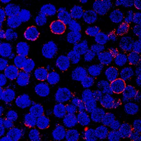 CD43 was detected in immersion fixed human peripheral blood mononuclear cells (PBMCs) using Mouse Anti-Human CD43 Monoclonal Antibody (Catalog # MAB20381) at 8 µg/mL for 3 hours at room temperature. Cells were stained using the NorthernLights™ 557-conjugated Anti-Mouse IgG Secondary Antibody (red; Catalog # NL007) and counterstained with DAPI (blue). Specific staining was localized to cell surfaces. View our protocol for Fluorescent ICC Staining of Non-adherent Cells.