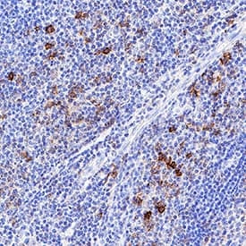 CD43 was detected in immersion fixed paraffin-embedded sections of human tonsil using Mouse Anti-Human CD43 Monoclonal Antibody (Catalog # MAB20381) at 1.7 µg/mL for 1 hour at room temperature followed by incubation with the Anti-Mouse IgG VisUCyte™ HRP Polymer Antibody (Catalog # VC001). Before incubation with the primary antibody, tissue was subjected to heat-induced epitope retrieval using Antigen Retrieval Reagent-Basic (Catalog # CTS013). Tissue was stained using DAB (brown) and counterstained with hematoxylin (blue). Specific staining was localized to cell surfaces in lymphocytes. View our protocol for IHC Staining with VisUCyte HRP Polymer Detection Reagents.