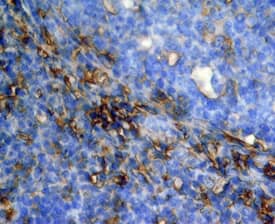 CD44 was detected in immersion fixed paraffin-embedded sections of human tonsil using Sheep Anti-Human CD44 Antigen Affinity-purified Polyclonal Antibody (Catalog # AF3660) at 15 µg/mL overnight at 4 °C. Tissue was stained using the Anti-Sheep HRP-DAB Cell & Tissue Staining Kit (brown; Catalog # CTS019) and counterstained with hematoxylin (blue). Specific staining was localized to cell surfaces and cytoplasm. View our protocol for Chromogenic IHC Staining of Paraffin-embedded Tissue Sections.