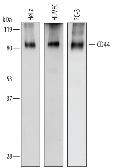 Western blot shows lysates of HeLa human cervical epithelial carcinoma cell line, HUVEC human umbilical vein endothelial cells, and PC-3 human prostate cancer cell line. PVDF membrane was probed with 0.2 µg/mL of Sheep Anti-Human CD44 Antigen Affinity-purified Polyclonal Antibody (Catalog # AF3660) followed by HRP-conjugated Anti-Sheep IgG Secondary Antibody (Catalog # HAF016). Specific bands were detected for CD44 at approximately 85 kDa (as indicated). This experiment was conducted under reducing conditions and using Immunoblot Buffer Group 1.