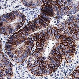 Immunohistochemistry CD44 Antibody (2F10) [Unconjugated] - v6
