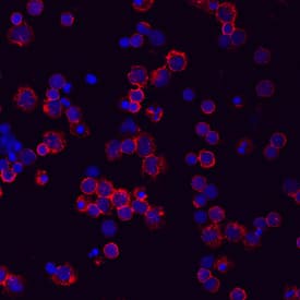 CD44 was detected in immersion fixed human peripheral blood mononuclear cells (PBMCs) using Mouse Anti-Human CD44s Pan Specific Monoclonal Antibody (Catalog # MAB7045) at 10 µg/mL for 3 hours at room temperature. Cells were stained using the NorthernLights™ 557-conjugated Anti-Mouse IgG Secondary Antibody (red; NL007) and counterstained with DAPI (blue). Specific staining was localized to cell surfaces. View our protocol for Fluorescent ICC Staining of Non-adherent Cells.