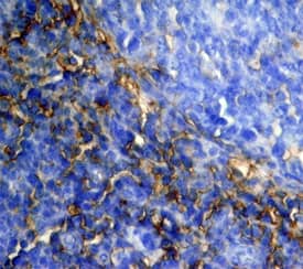 CD44 was detected in immersion fixed paraffin-embedded sections of human tonsil using Mouse Anti-Human CD44s Pan Specific Monoclonal Antibody (Catalog # MAB7045) at 15 µg/mL overnight at 4 °C. Tissue was stained using the Anti-Mouse HRP-DAB Cell & Tissue Staining Kit (brown; CTS002) and counterstained with hematoxylin (blue). View our protocol for Chromogenic IHC Staining of Paraffin-embedded Tissue Sections.