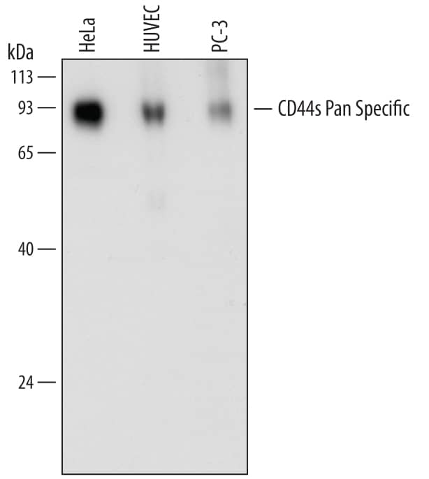 Western blot shows lysates of HeLa human cervical epithelial carcinoma cell line, HUVEC human umbilical vein endothelial cells, and PC-3 human prostate cancer cell line. PVDF membrane was probed with 0.2 µg/mL of Mouse Anti-Human CD44s Pan Specific Monoclonal Antibody (Catalog # MAB7045) followed by HRP-conjugated Anti-Mouse IgG Secondary Antibody (HAF007). Specific bands were detected for CD44 at approximately 80 to 100 kDa (as indicated). This experiment was conducted under reducing conditions and using Immunoblot Buffer Group 1.