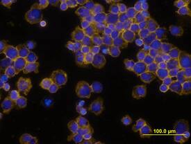 CD45 was detected in immersion fixed human peripheral blood mononuclear cells (PBMCs) stimulated with PHA blast using Mouse Anti-Human CD45 Monoclonal Antibody (Catalog # MAB1430) at 10 µg/mL for 3 hours at room temperature. Cells were stained using the NorthernLights™ 557-conjugated Anti-Mouse IgG Secondary Antibody (yellow; Catalog # NL007) and counter-stained with DAPI (blue). View our protocol for Fluorescent ICC Staining of Non-adherent Cells.