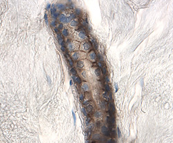 CD46 was detected in immersion fixed paraffin-embedded sections of human skin using 1.7 &micro;g/mL Goat Anti-Human CD46 Antigen Affinity-purified Polyclonal Antibody (Catalog # AF2005) overnight at 4 &deg;C. Tissue was stained with the Anti-Goat HRP-DAB Cell & Tissue Staining Kit (brown; Catalog # CTS008) and counterstained with hematoxylin (blue). View our protocol for Chromogenic IHC Staining of Paraffin-embedded Tissue Sections.