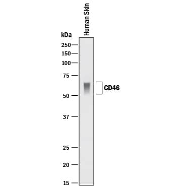 Western blot shows lysate of human skin tissue. PVDF membrane was probed with 1 µg/mL of Goat Anti-Human CD46 Antigen Affinity-purified Polyclonal Antibody (Catalog # AF2005) followed by HRP-conjugated Anti-Goat IgG Secondary Antibody (Catalog # HAF017). A specific band was detected for CD46 at approximately 50-70 kDa (as indicated). This experiment was conducted under reducing conditions and using Immunoblot Buffer Group 1.