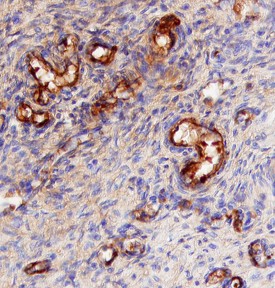 CD47 was detected in immersion fixed paraffin-embedded sections of human placenta using 5 &micro;g/mL Sheep Anti-Human CD47 Antigen Affinity-purified Polyclonal Antibody (Catalog # AF4670) overnight at 4 &deg;C. Tissue was stained with the Anti-Sheep HRP-DAB Cell & Tissue Staining Kit (brown; Catalog # CTS019) and counterstained with hematoxylin (blue). View our protocol for Chromogenic IHC Staining of Paraffin-embedded Tissue Sections.