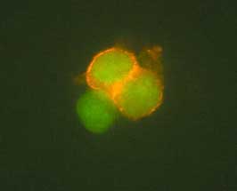 CD4 was detected in immersion fixed human T cells using 2 µg/mL Goat Anti-Human CD4 Antigen Affinity-purified Polyclonal Antibody (Catalog # AF‑379‑NA) for 3 hours at room temperature. Cells were stained (red) and counterstained (green). View our protocol for Fluorescent ICC Staining of Cells on Coverslips.