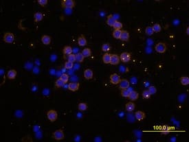 CD4 was detected in immersion fixed human peripheral blood mononuclear cells (PBMCs) using Goat Anti-Human CD4 Antigen Affinity-purified Polyclonal Antibody (Catalog # AF-379-NA) at 10 µg/mL for 3 hours at room temperature. Cells were stained using the NorthernLights™ 557-conjugated Anti-Goat IgG Secondary Antibody (yellow; NL001) and counterstained with DAPI (blue). View our protocol for Fluorescent ICC Staining of Non-adherent Cells.
