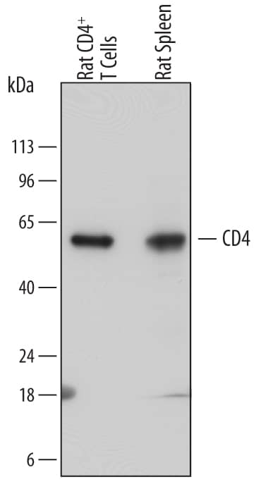 Western blot shows lysates of rat CD4+T cells and rat spleen tissue. PVDF membrane was probed with 1 µg/mL of Sheep Anti-Rat CD4 Antigen Affinity-purified Polyclonal Antibody (Catalog # AF6439) followed by HRP-conjugated Anti-Sheep IgG Secondary Antibody (Catalog # HAF016). A specific band was detected for CD4 at approximately 55 kDa (as indicated). This experiment was conducted under reducing conditions and using Immunoblot Buffer Group 1.