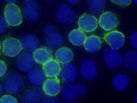 CD4 was detected in immersion fixed human peripheral blood mononuclear cells (PBMCs) using Goat Anti-Human CD4 Alexa Fluor® 488-conjugated Antigen Affinity-purified Polyclonal Antibody (Catalog # FAB8165G, green) at 10 µg/mL for 3 hours at room temperature. Cells were counterstained with DAPI (blue). Specific staining was localized to cell surfaces. View our protocol for Fluorescent ICC Staining of Non-adherent Cells.