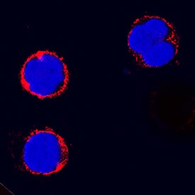 CD4 was detected in immersion fixed canine peripheral blood mononuclear cells (PBMCs) using Mouse Anti-Canine CD4 Monoclonal Antibody (Catalog # MAB2410) at 25 µg/mL for 3 hours at room temperature. Cells were stained using the NorthernLights™ 557-conjugated Anti-Mouse IgG Secondary Antibody (red; Catalog # NL007) and counterstained with DAPI (blue). Specific staining was localized to cytoplasm. View our protocol for Fluorescent ICC Staining of Non-adherent Cells.